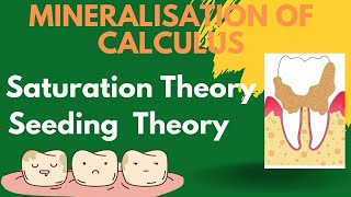 Theories of mineralisation of calculus  Periodontology [upl. by Scott]