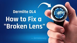 Dermlite DL4 Dermatoscope quotBroken Lensquot Replacement [upl. by Aneez]