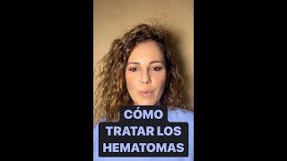 CÓMO TRATAR LOS HEMATOMAS [upl. by Rist597]