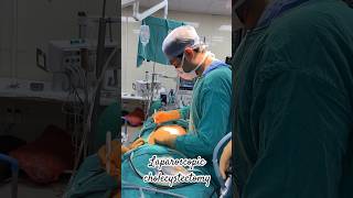 Laparoscopic cholecystectomy  bestsurgeon reels doctor lucknow best neet surgerylife yt [upl. by Conger]