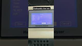 Prothrombin time test  Coagulation test  PT test  INR test  APTT test labtechnician dmlt [upl. by Karoline529]