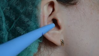 Серная пробка Удаление в домашних условиях Ear wax Removal at home [upl. by Rakabuba]