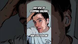 Day 490 of stopping hair loss 🤝 shorts menshealth [upl. by Coreen]