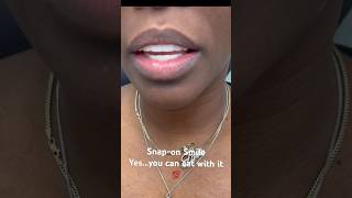 Most asked question Can you eat with Snap on Smile  Watch this [upl. by Jaylene]