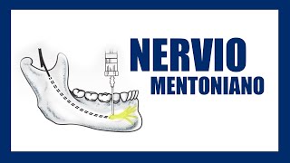 Técnica de anestesia Nervio mentoniano [upl. by Klinger781]