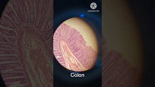 Small intestine Colon Histology mbbs shorts trending [upl. by Kernan349]