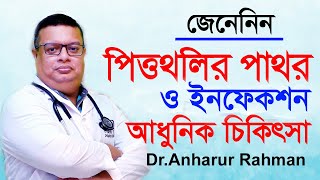 পিত্তথলির পাথর ও ইনফেকশন আধুনিক চিকিৎসা  Gall bladder stone infection symptoms Treatment [upl. by Nnanerak]