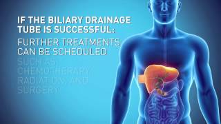 Biliary Drain [upl. by Cyrie]