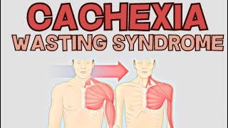 Cachexia  Wasting Syndrome  Explained [upl. by Azilanna]