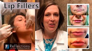 Lip Filler Injections Best Fillers Types of Results Duration with Dr Michelle Ellern [upl. by Atinar922]