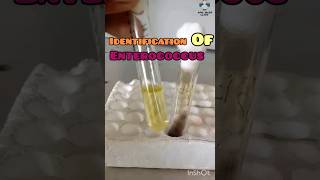 Identify Enterococcus Fecalis  Bile Esculin Agar  Catalase Test  GPC bacteriology microbiology [upl. by Oicnanev959]