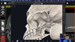 The Ins and Outs of the Pterygopalatince Fossa [upl. by Nedra]