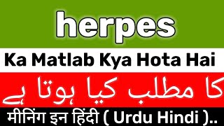 Herpes Meaning  Herpes Meaning In Urdu  Herpes Ka Matlab Kya Hota Hai  Herpes Ka Meaning Kya Hai [upl. by Ocramed1]