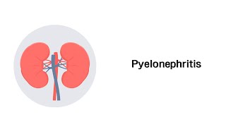 Nierenbeckenentzündung  Pyelonephritis Erkrankungen der Niere [upl. by Mendie246]