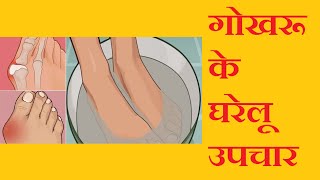 गोखुर के घरेलु उपचार  Home remedies for Bunions  TREATMENT OF EMBARRASSING BUNIONS  DESI NUSKHE [upl. by Alikam]