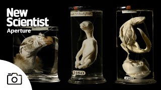 Hunterian Museum puts weird and wonderful anatomical curiosities back on display [upl. by Anasor]