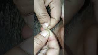 hair headlice barbershop nomorelice hairstyle headliceremoval edsheeren satisfying haircare [upl. by Asante493]