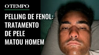 Entenda o que é peeling de fenol procedimento estético que matou jovem de 27 anos [upl. by Fredie632]