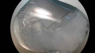 Growing Sodium Thiosulfate Crystals [upl. by Aklim]