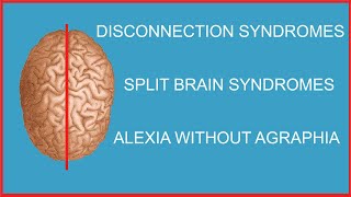 DISCONNECTION SYNDROMESSPLIT BRAIN SYNDROMESALEXIA WITHOUT AGRAPHIA [upl. by Ahsoyem922]