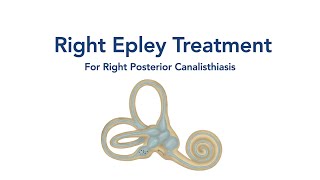 At Home Right Epley Maneuver for BPPV Vertigo [upl. by Yttisahc98]