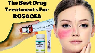 The Best Drug Treatments For ROSACEA  Rosacea Prevention Tips [upl. by Magulac364]