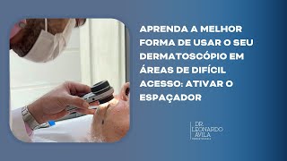 Aprenda a melhor forma de usar o seu dermatoscópio em áreas de difícil acesso  Ativar o espaçador [upl. by Inahet]