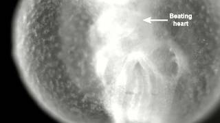 Heartbeat movie of an E85 mouse embryo after 12 h of WEC [upl. by Merrie902]