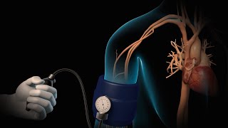 High Blood Pressure  Hypertension  Nucleus Health [upl. by Almire]