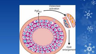 ODONTOGENIC CYSTS PART 1 Oral Pathology  3rd BDS [upl. by Cheshire540]