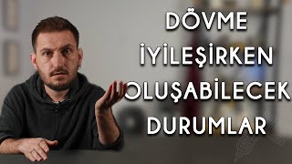 DÖVME İYİLEŞİRKEN NELER OLABİLİR Dövmenizde sivilce çıkması normal mi [upl. by Anwadal]