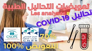 ✅ CNOPS CNSS تعويضات التحاليل الطبية [upl. by Roldan]