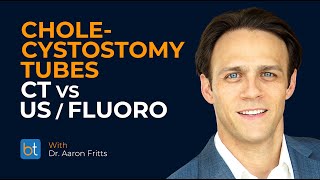 Cholecystostomy Tubes CT vs Ultrasound  Fluoro  BackTable Clips [upl. by Anirdnaxela]