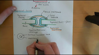 Rheumatoid Arthritis and Antirheumatoid Drugs Part 1 [upl. by Edette]