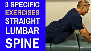 3 Best Exercises For Straightening Lumbar Spine Loss Of Lumbar Lordosis  Dr Greg Kramer [upl. by Yblek]