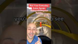 NOT Your Everyday Ankle Sprain  Doctor Explains [upl. by Schrader]