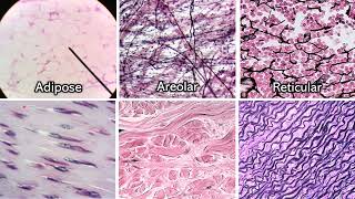 Identifying Connective Tissue  Review and Practice [upl. by Jacoby430]