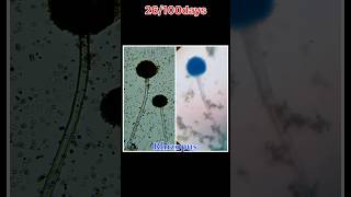 Rhizopus bacteria sudhanshuvlogs shorts minivlog dailyvlog [upl. by Ahsinam150]