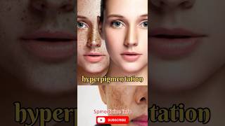 Skin care tips best for skin careytshorts shorts viralshorts medical skincarespsaklani0888 [upl. by Hurty]