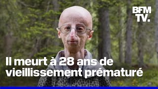 À 28 ans Sammy Basso le plus vieux malade au monde atteint de vieillissement prématuré est mort [upl. by Sixela865]