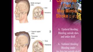 Neurologic Emergencies [upl. by Airotcivairam]