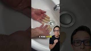 Fenômeno de Raynaud 😱medicina medico enfermeiro enfermagem curiosidades mão gelada e pálida [upl. by Phares677]