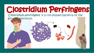 Clostridium Perfringens  Gas gangrene  What is the treatment for Clostridium perfringens [upl. by Nirihs20]