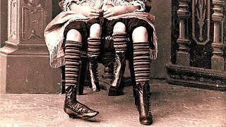 The Story of Myrtle Corbin the Real Life Four Legged Girl [upl. by Enahsal]