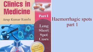 Haemorrhagic Spots part 1 [upl. by Jaret]