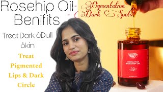 Vrikshveda Rosehip Oil Benifits  Uses Review  🤩 [upl. by Havens295]