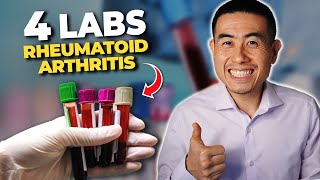 4 Rheumatoid Arthritis LABS that you Need to Know  Rheumatologist Dr Micah Yu [upl. by Alyal]