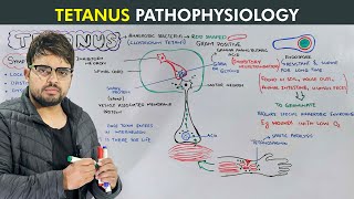 Tetanus Causes Symptoms Prevention and Treatment Biology lecture [upl. by Nathanoj]