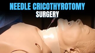 quotDemystifying Needle Cricothyrotomy An InDepth Animated Guide by Dr Vyshnaviquot [upl. by Paige]