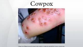 Cowpox [upl. by Ahsenyl]